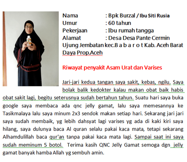 Obat Varises Tradisional