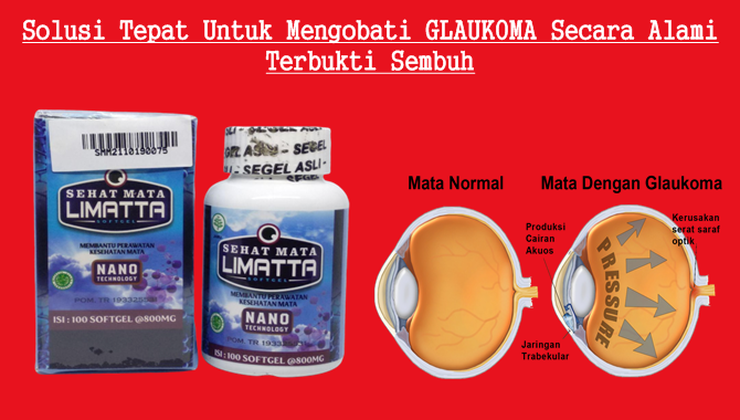 Obat Glaukoma Alami Tanpa Operas