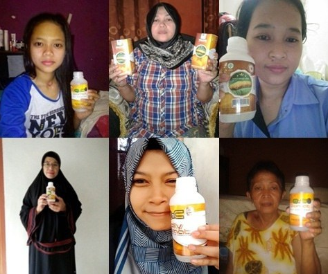 Obat Bisul Alami Paling Ampuh